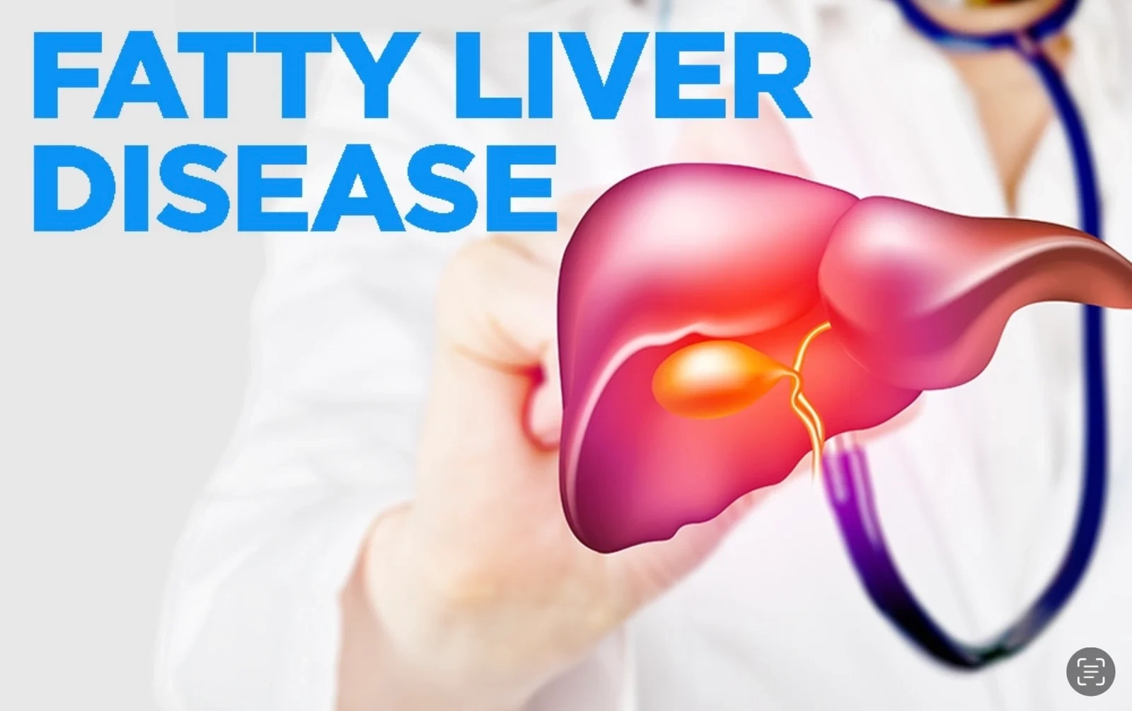 Fatty Liver Disease Or Hepatic Steatosis!