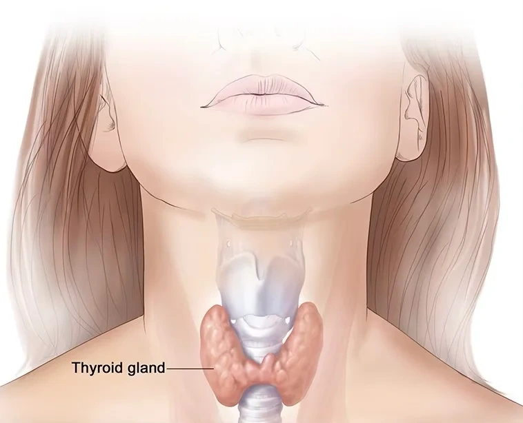 Hypothyroidism