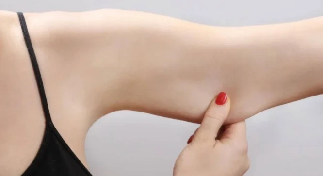 Sagging Skin After Weight Loss!