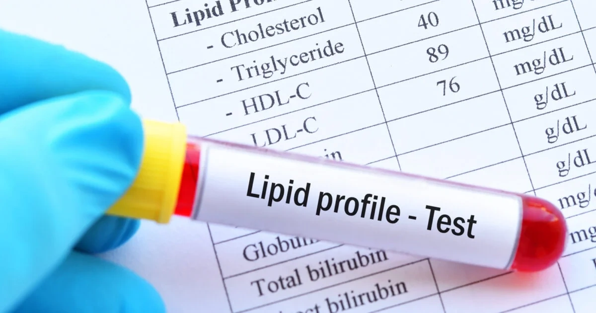 Understanding Lipid Profile!