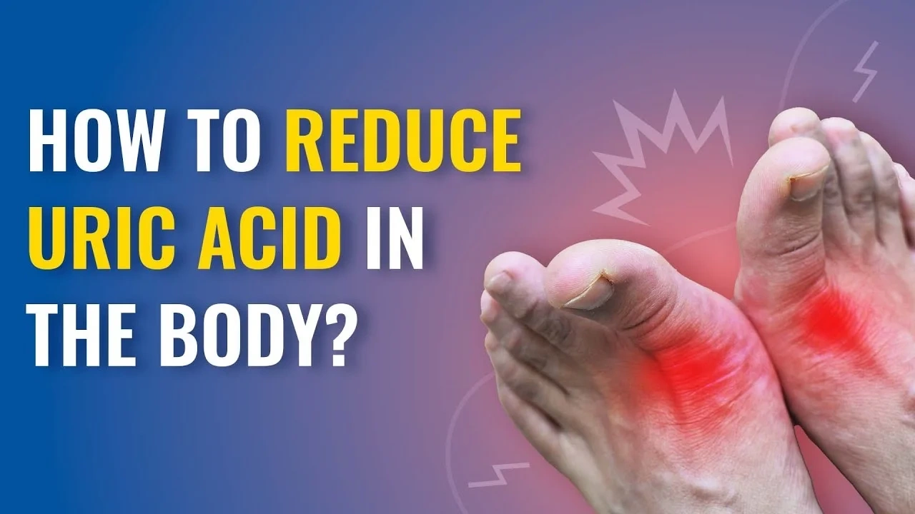 Uric Acid, Gout And Kidney Stones!